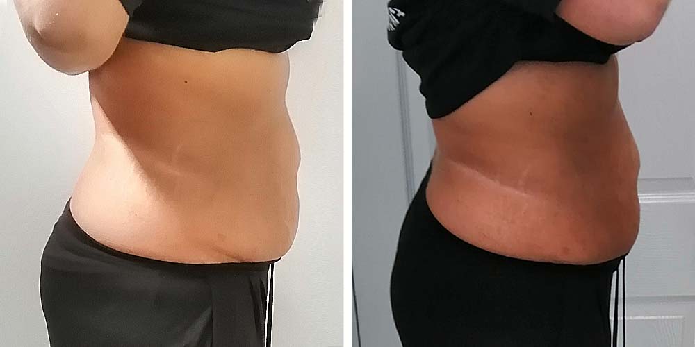 Belly fat reduction of 7 inches in 2 days
